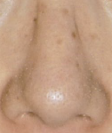 鼻2
